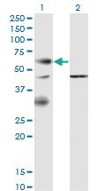 Anti-EPOR Mouse Monoclonal Antibody [clone: 3F6]