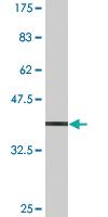 Anti-CDK9 Mouse Monoclonal Antibody [clone: 2D7]