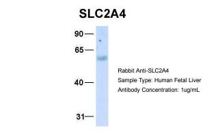 Anti-SLC2A4 Rabbit Polyclonal Antibody