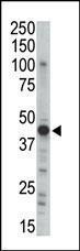 Anti-PRKAR2B Rabbit Polyclonal Antibody (HRP (Horseradish Peroxidase))