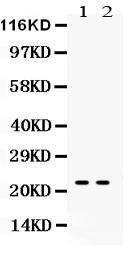 Anti-Lipocalin 2 Antibody