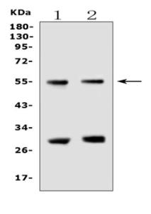 EPO Receptor primary antibodies WB testing 2