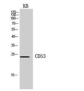 Western blot analysis of KB cells using Anti-CD53 Antibody