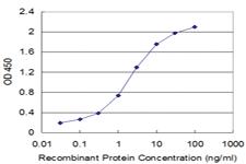 Anti-EPOR Mouse Monoclonal Antibody [clone: 3F6]