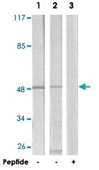 Anti-TRIP13 Rabbit Polyclonal Antibody