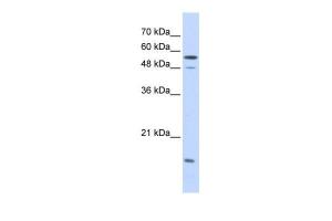 Anti-KPNA2 Rabbit Polyclonal Antibody