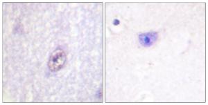 Antibody anti-SP1 A95471-100 100 µg