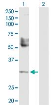 Anti-TREX1 Rabbit Polyclonal Antibody