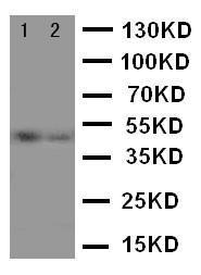 Anti-Vitamin D Receptor Rabbit Polyclonal Antibody