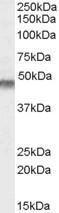 Anti-KCNJ11 Antibody (A83251) (0.1 µg/ml) staining of Human Muscle lysate (35 µg protein in RIPA buffer). Primary incubation was 1 hour. Detected by chemiluminescence