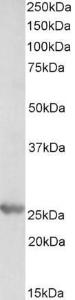 Anti-PSMB4 antibody