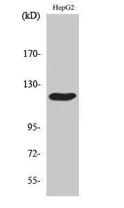 Western blot analysis of various cells using Anti-CBL Antibody