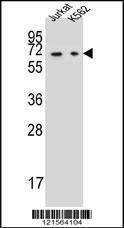 Anti-DPYS Rabbit Polyclonal Antibody (AP (Alkaline Phosphatase))