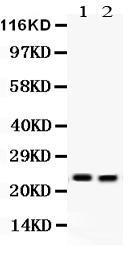 Anti-Lipocalin 2 Antibody