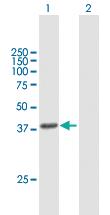 Anti-HSD3B1 Mouse Polyclonal Antibody