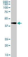 Anti-TREX1 Rabbit Polyclonal Antibody