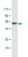 Anti-CD320 Mouse Monoclonal Antibody [clone: 4F2]