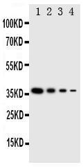 Anti-NTAL Rabbit Polyclonal Antibody