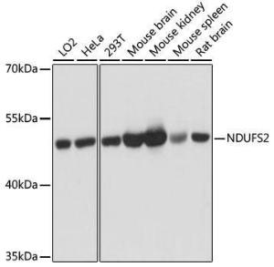 Western blot analysis of extracts of various cell lines, using Anti-NDUFS2 Antibody (A92953) at 1:3000 dilution