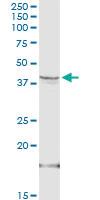 Anti-HSD3B1 Rabbit Polyclonal Antibody