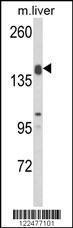 Anti-ADAMTS18 Rabbit Polyclonal Antibody (APC (Allophycocyanin))