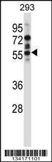 Anti-CAMK2D Rabbit Polyclonal Antibody (FITC (Fluorescein Isothiocyanate))