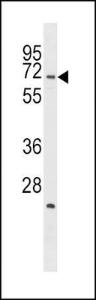 Anti-STK39 Rabbit Polyclonal Antibody