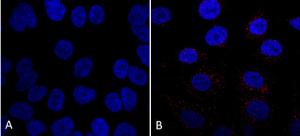 Immunocytochemistry/Immunofluorescence analysis of human A549 cells, using Anti-VPS35 Antibody [7E4] (A305036), at 1:5 (tissue culture supernatant)