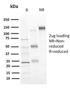 SDS-PAGE analysis of Anti-CD73 Antibody [NT5E/2646] under non-reduced and reduced conditions; showing intact IgG and intact heavy and light chains, respectively. SDS-PAGE analysis confirms the integrity and purity of the Antibody