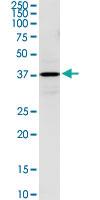 Anti-HSD3B1 Rabbit Polyclonal Antibody