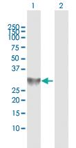 Anti-CAPZA3 Rabbit Polyclonal Antibody