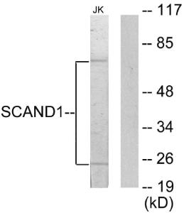 Western blot analysis of lysates from Jurkat cells using Anti-SCAND1 Antibody. The right hand lane represents a negative control, where the antibody is blocked by the immunising peptide