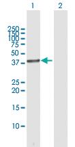 Anti-HSD3B1 Rabbit Polyclonal Antibody