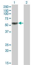 Anti-KLF12 Mouse Monoclonal Antibody [clone: 3E4]