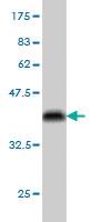 Anti-SH3RF1 Mouse Monoclonal Antibody [clone: 3H3]