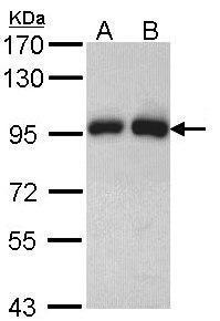 Anti-GSN Rabbit Polyclonal Antibody