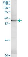 Anti-HSD3B1 Rabbit Polyclonal Antibody