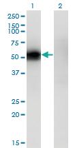 Anti-KLF12 Mouse Monoclonal Antibody [clone: 3D2]