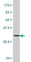 Anti-ERBB2IP Mouse Monoclonal Antibody [clone: 10D2]