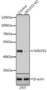 Western blot analysis of extracts from normal (control) and NDUFS2 knockout (KO) 293T cells, using Anti-NDUFS2 Antibody (A92953) at 1:3000 dilution