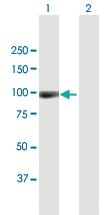 Anti-ACAN Mouse Polyclonal Antibody