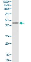 Anti-HSD3B1 Rabbit Polyclonal Antibody