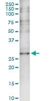 Anti-CAPZA3 Rabbit Polyclonal Antibody