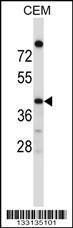 Anti-OR4C16 Rabbit Polyclonal Antibody (HRP (Horseradish Peroxidase))