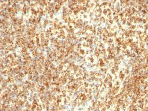 Anti-CD20 Mouse Monoclonal Antibody [clone: L26 + IGEL/773]