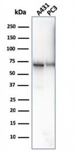 Western blot analysis of A431 and PC-3 cell lysates using Anti-CD73 Antibody [NT5E/2646]