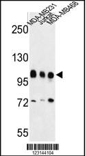 Anti-CGA Rabbit Polyclonal Antibody