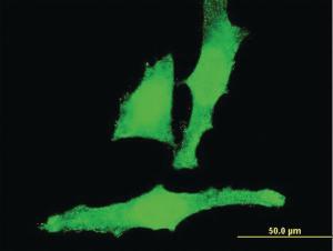 Anti-ACAN Mouse Monoclonal Antibody [clone: 2A8]