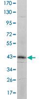 Anti-ITGA5 Mouse Monoclonal Antibody [clone: 10F6]