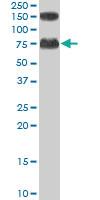 Anti-ACOX2 Goat Polyclonal Antibody